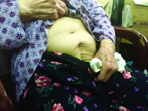 94岁老人掀衣露长疤控诉日军暴行